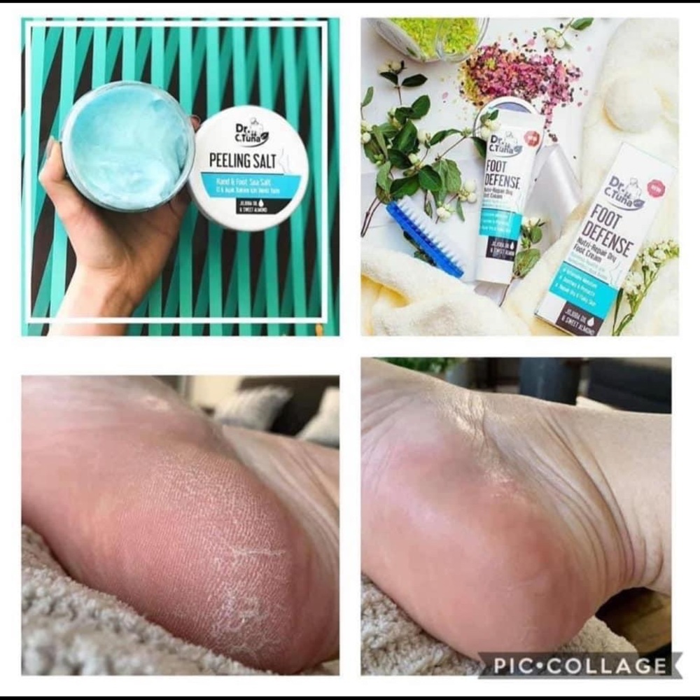 Foot care package